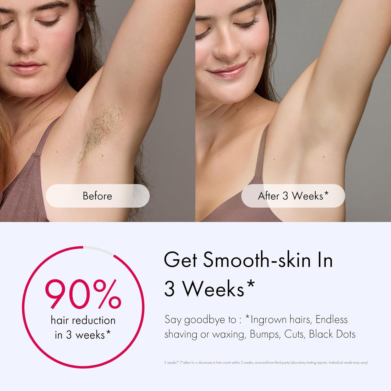 3 Modes &amp;amp;amp;amp;amp; Auto Flashing for Fast Full Body Hair Removal from Home - Purple